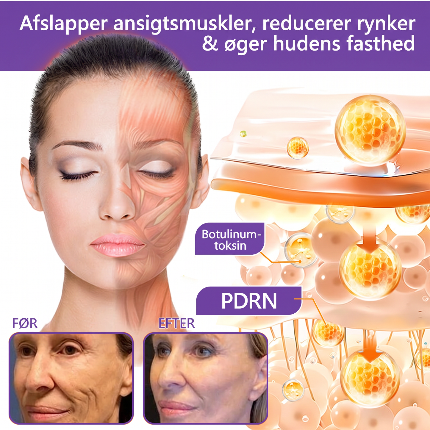 💎 Vitalisys ® PDRN Multi-Peptid Massage Kropsrullecreme - Anti-aldring, fugtgivende, hudstramning og løft, genopretter hudens tilstand, jævner hudtonen, behandling af akne og mørke pletter, fjerner vorter samt lindrer mod rødme og psoriasis.