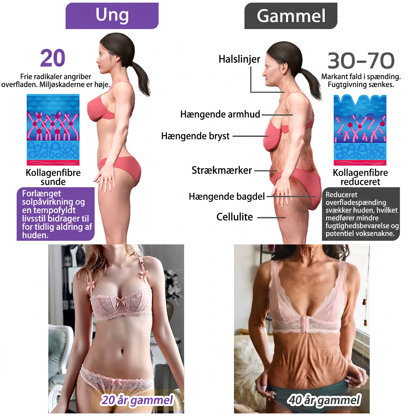 💎 Vitalisys ® PDRN Multi-Peptid Massage Kropsrullecreme - Anti-aldring, fugtgivende, hudstramning og løft, genopretter hudens tilstand, jævner hudtonen, behandling af akne og mørke pletter, fjerner vorter samt lindrer mod rødme og psoriasis.