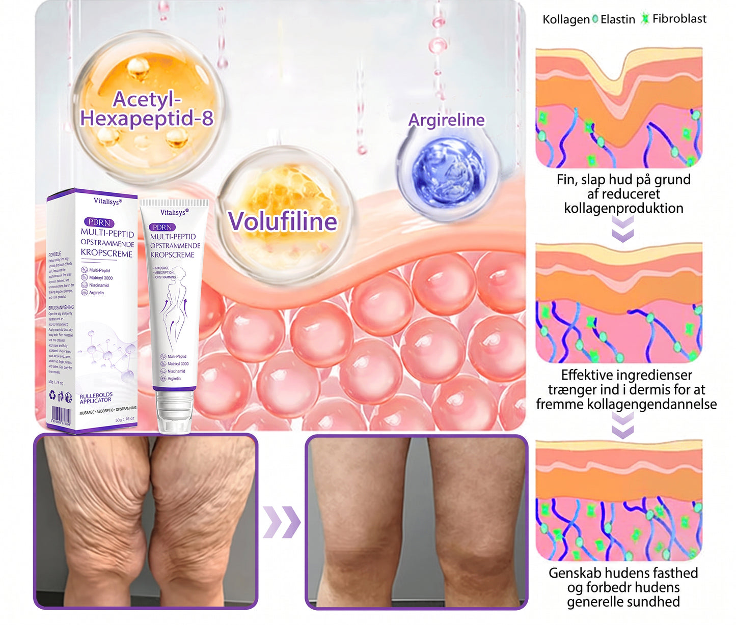 💎 Vitalisys ® PDRN Multi-Peptid Massage Kropsrullecreme - Anti-aldring, fugtgivende, hudstramning og løft, genopretter hudens tilstand, jævner hudtonen, behandling af akne og mørke pletter, fjerner vorter samt lindrer mod rødme og psoriasis.