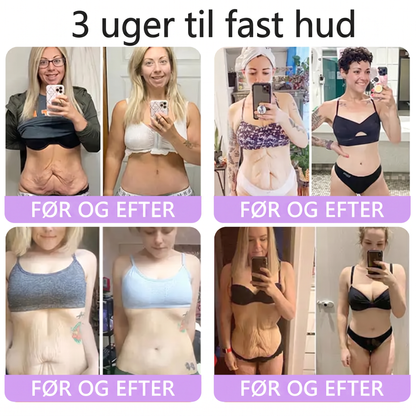 💎 Vitalisys ® PDRN Multi-Peptid Massage Kropsrullecreme - Anti-aldring, fugtgivende, hudstramning og løft, genopretter hudens tilstand, jævner hudtonen, behandling af akne og mørke pletter, fjerner vorter samt lindrer mod rødme og psoriasis.