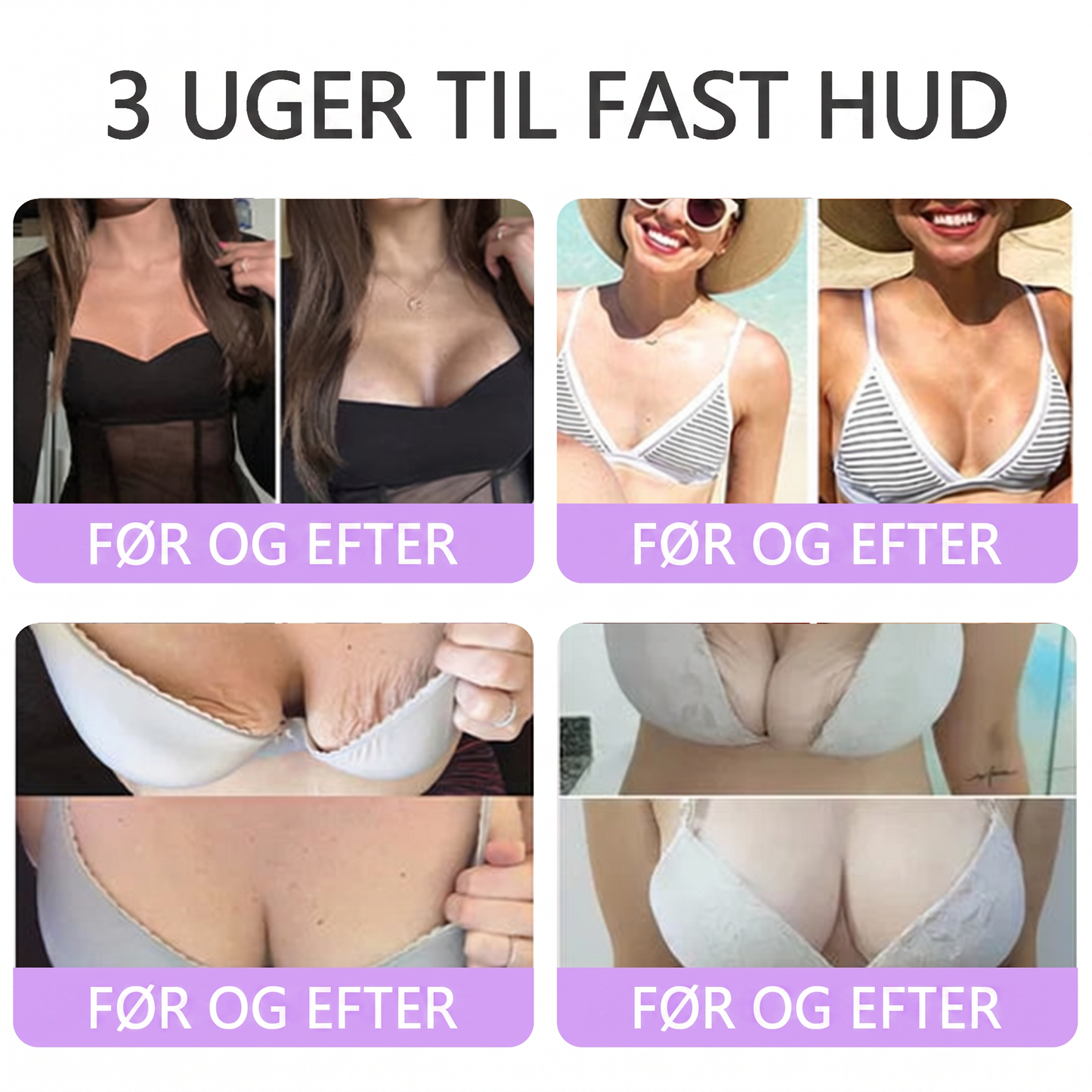 💎 Vitalisys ® PDRN Multi-Peptid Massage Kropsrullecreme - Anti-aldring, fugtgivende, hudstramning og løft, genopretter hudens tilstand, jævner hudtonen, behandling af akne og mørke pletter, fjerner vorter samt lindrer mod rødme og psoriasis.