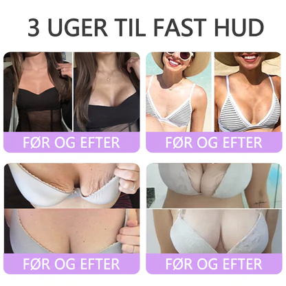 💎 Vitalisys ® PDRN Multi-Peptid Massage Kropsrullecreme - Anti-aldring, fugtgivende, hudstramning og løft, genopretter hudens tilstand, jævner hudtonen, behandling af akne og mørke pletter, fjerner vorter samt lindrer mod rødme og psoriasis.