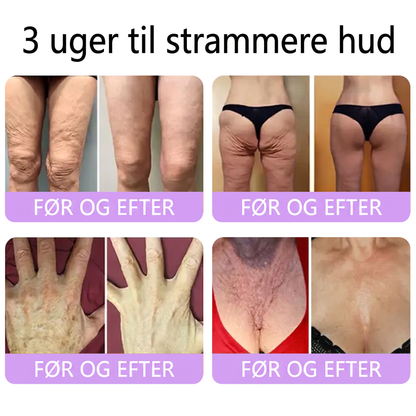 💎 Vitalisys ® PDRN Multi-Peptid Massage Kropsrullecreme - Anti-aldring, fugtgivende, hudstramning og løft, genopretter hudens tilstand, jævner hudtonen, behandling af akne og mørke pletter, fjerner vorter samt lindrer mod rødme og psoriasis.