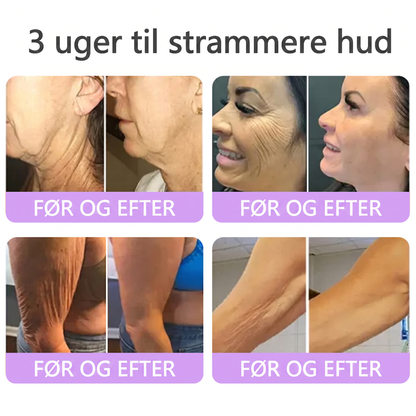 💎 Vitalisys ® PDRN Multi-Peptid Massage Kropsrullecreme - Anti-aldring, fugtgivende, hudstramning og løft, genopretter hudens tilstand, jævner hudtonen, behandling af akne og mørke pletter, fjerner vorter samt lindrer mod rødme og psoriasis.