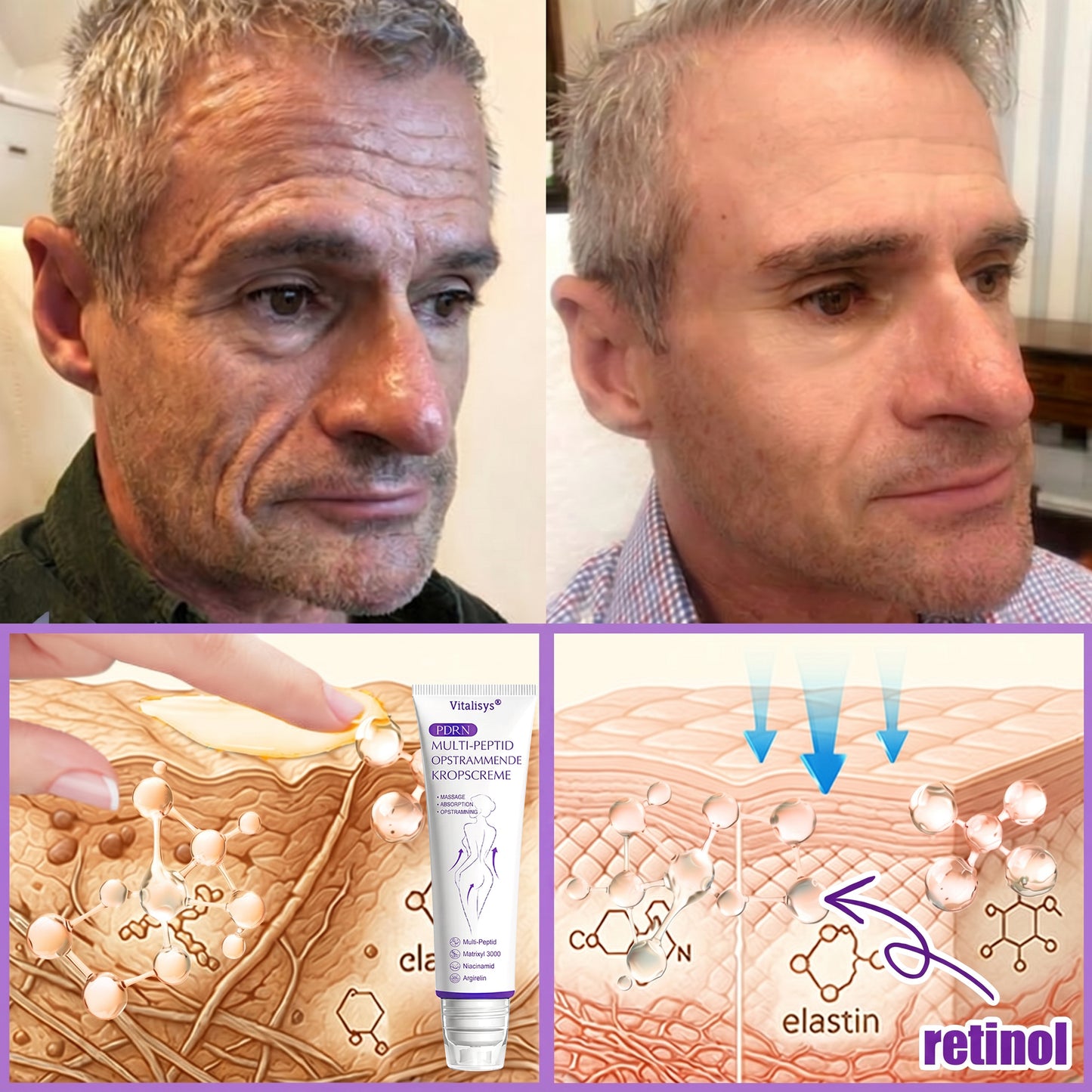 💎 Vitalisys ® PDRN Multi-Peptid Massage Kropsrullecreme - Anti-aldring, fugtgivende, hudstramning og løft, genopretter hudens tilstand, jævner hudtonen, behandling af akne og mørke pletter, fjerner vorter samt lindrer mod rødme og psoriasis.